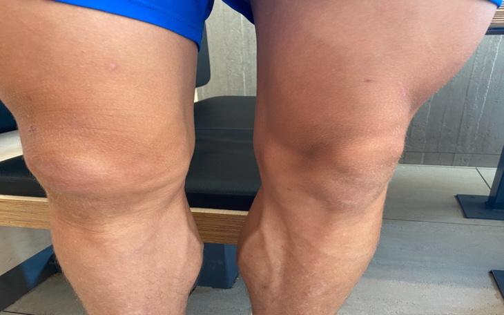 Zbiórka Operacja i leczenie piłkarza - zdjęcie główne