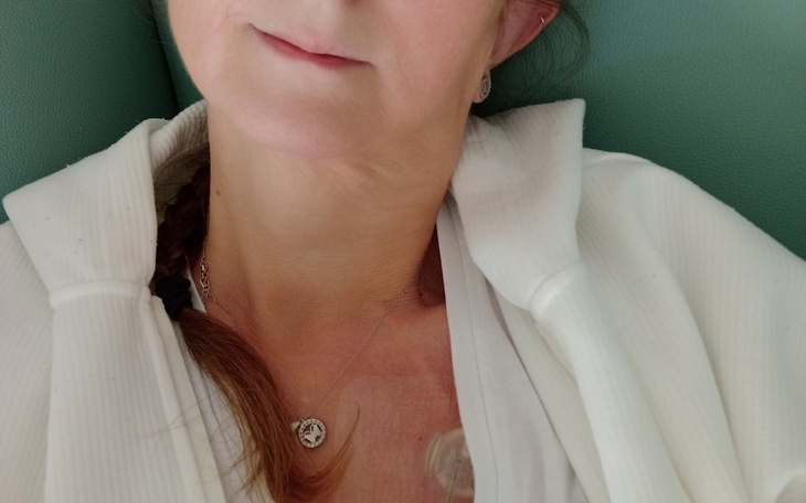 Kobieta w szpitalu, widok na jej szyję z cewnikiem.