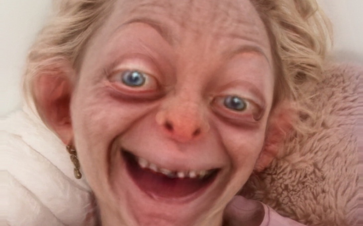 Osoba z nietypowym wyrazem twarzy, uśmiechająca się szeroko.