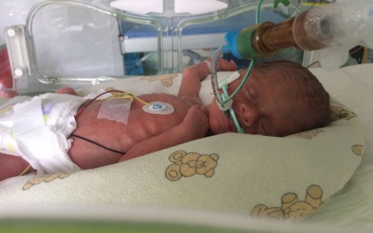 Zbiórka Refundacja wizyt dla wcześniaków - zdjęcie główne