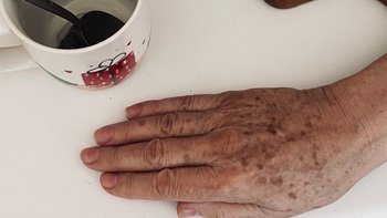 Zbiórka Pani Ewa nie chce być sama - miniaturka zdjęcia