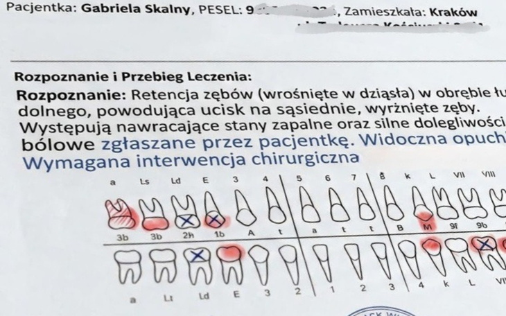 Widoczny królik z ogonem w czarnych uszach, spacer na zewnątrz