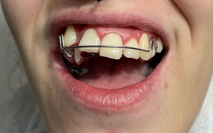 Zbiórka Wada zgryzu,proszę o marzenie - zdjęcie główne