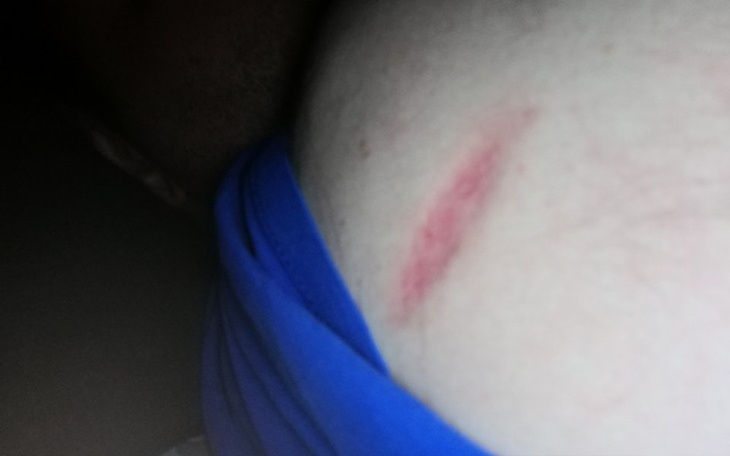 Zbiórka Na Unego - zdjęcie główne