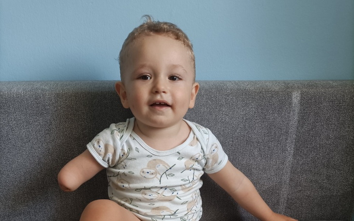 Zbiórka Zbiórka na protezę kosmetyczną - zdjęcie główne