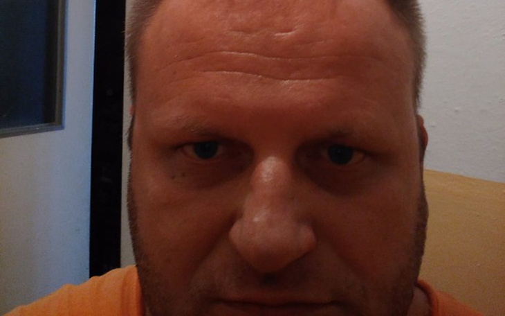 Zbiórka Stożek rogówki - zdjęcie główne