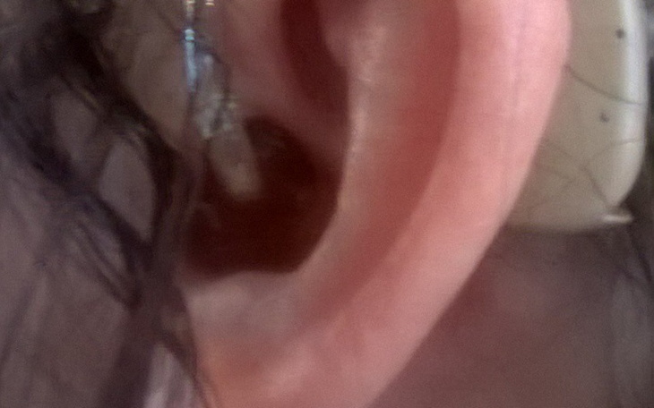 Zbiórka Aparaty słuchowe dla Violi - zdjęcie główne