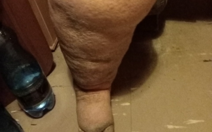 Zbiórka Potrzebne na leczenie mamy - zdjęcie główne