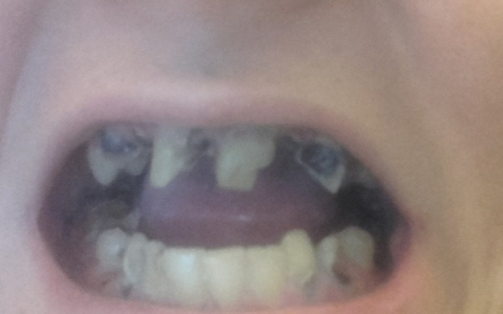 Zbiórka Na odbudowę uzębienia - zdjęcie główne