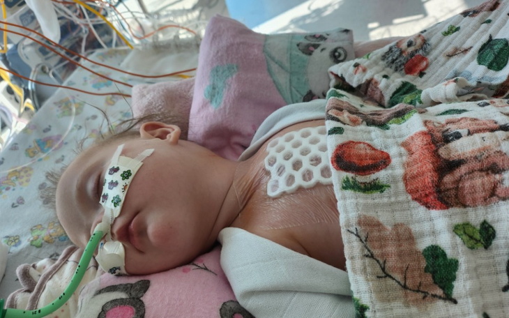 Małe dziecko w szpitalu, podłączone do aparatury medycznej.