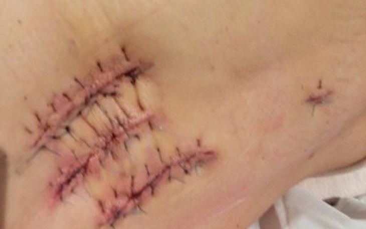 Zbiórka Nikodem Ciągle Walczyyy - zdjęcie główne