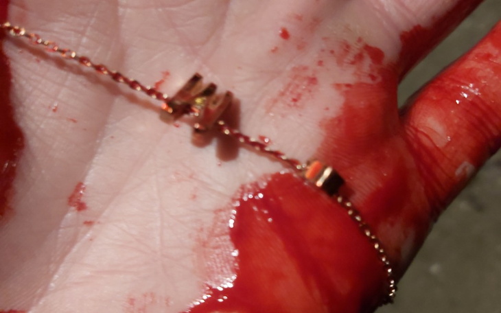 Zbiórka Zbieram dla Żony - zdjęcie główne