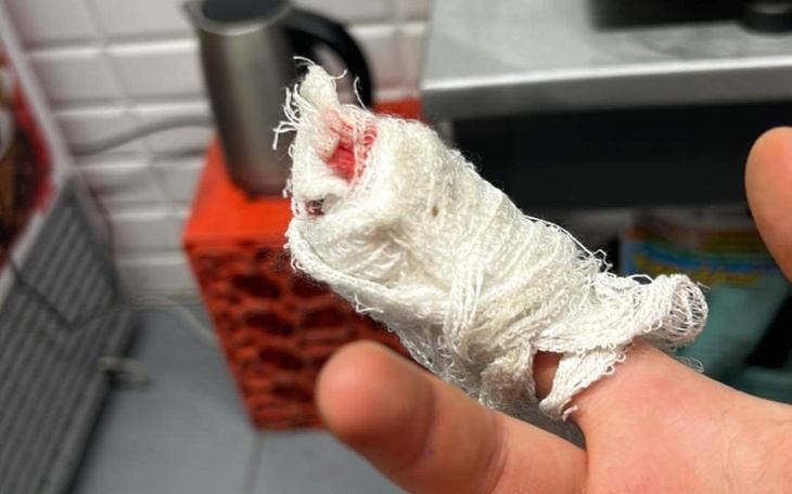 Zbiórka Powrót do normalności po wypadku - zdjęcie główne