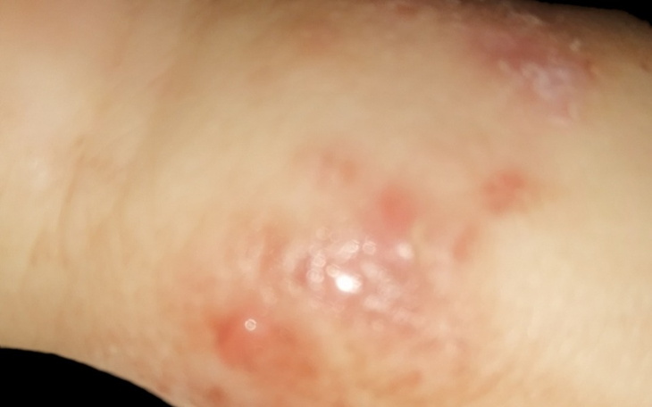 Zbiórka Leczenie i pomoc dla Filipka - zdjęcie główne