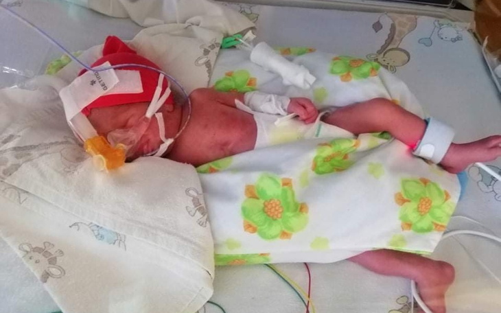 Noworodek w inkubatorze z rurkami medycznymi.