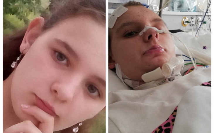 Dwie fotografie dziewczynki, jedna w zdrowym stanie, druga w szpitalu.