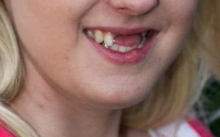 Zbiórka Zbiórka na Nowe zęby...... - zdjęcie główne