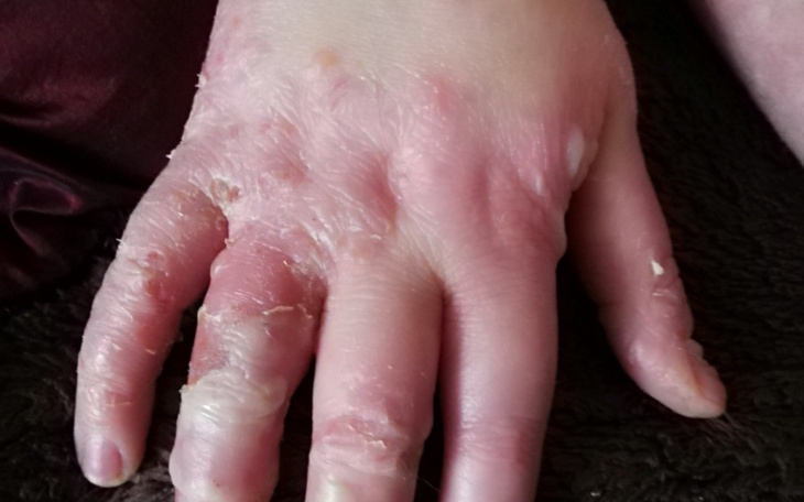 Zbiórka Zbiórka na leki dla corki - zdjęcie główne