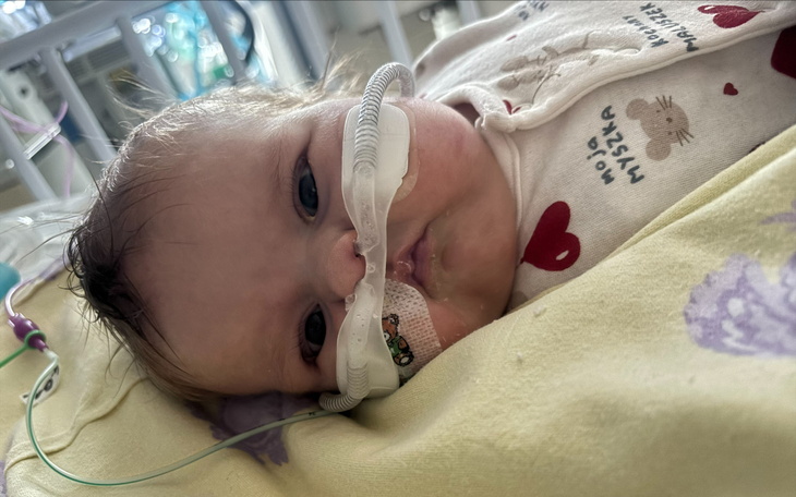 Noworodek z rurką tlenową w szpitalu, walczący o zdrowie.