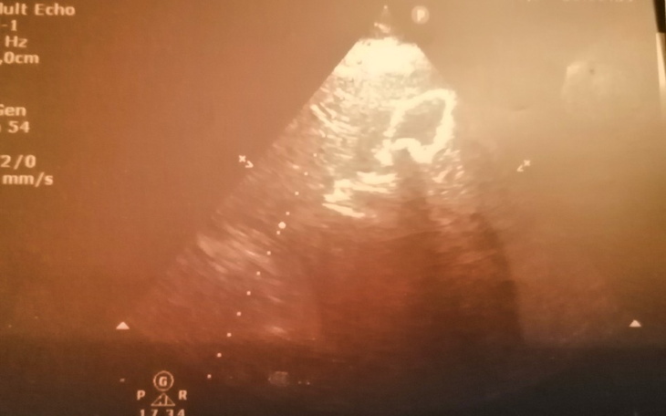 Zbiórka Marta Dubicka - zdjęcie główne