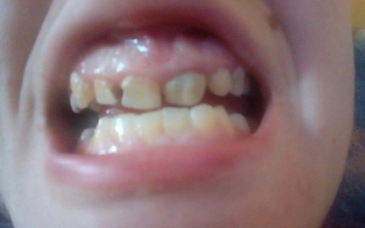 Zbiórka Na uśmiech bez wstydu - zdjęcie główne