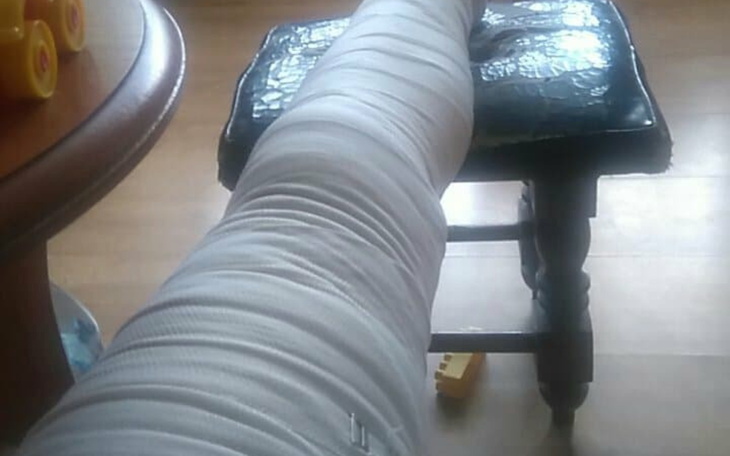 Zabandażowana noga leżąca na stole, symbolizująca kontuzję lub rekonwalescencję.