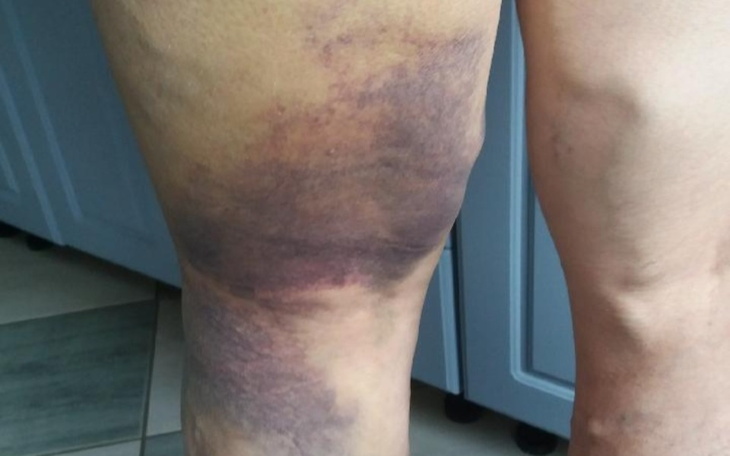 Zbiórka Pomagali innym teraz zostali sam - zdjęcie główne