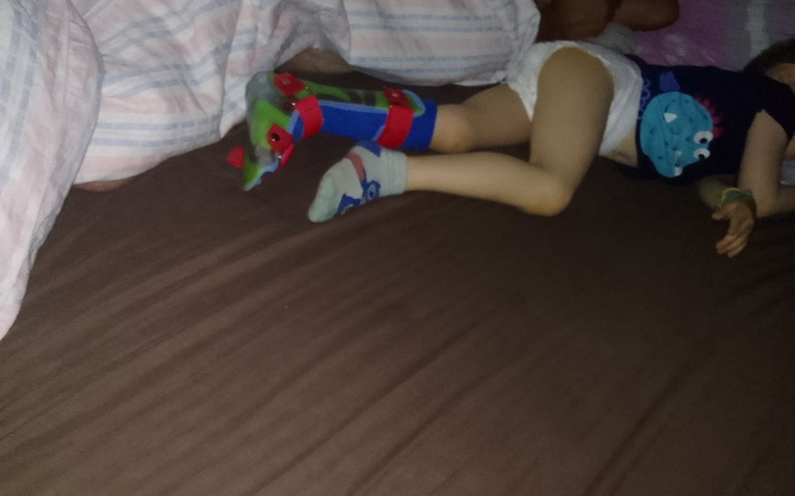 Zbiórka Porażenie mózgowe dziecięce - zdjęcie główne