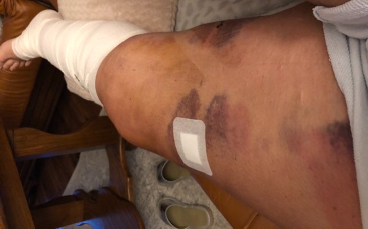 Zbiórka Ujarzmić bol - zdjęcie główne