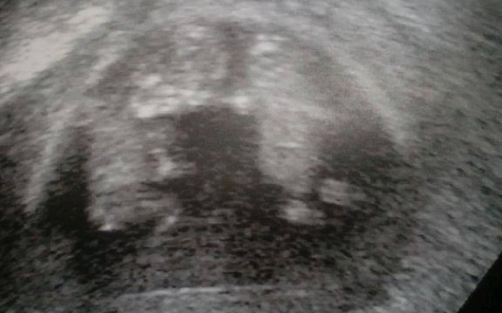 Zbiórka Zh - zdjęcie główne