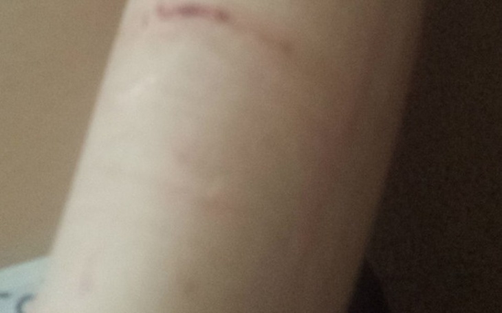 Zbiórka Dla Kaji na tatuaż - zdjęcie główne