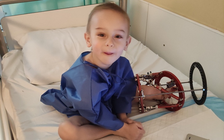 Chłopiec w szpitalnym łóżku z urządzeniem medycznym na nodze.