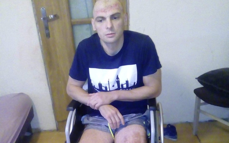 Zbiórka Potrzebne sa protezy - zdjęcie główne