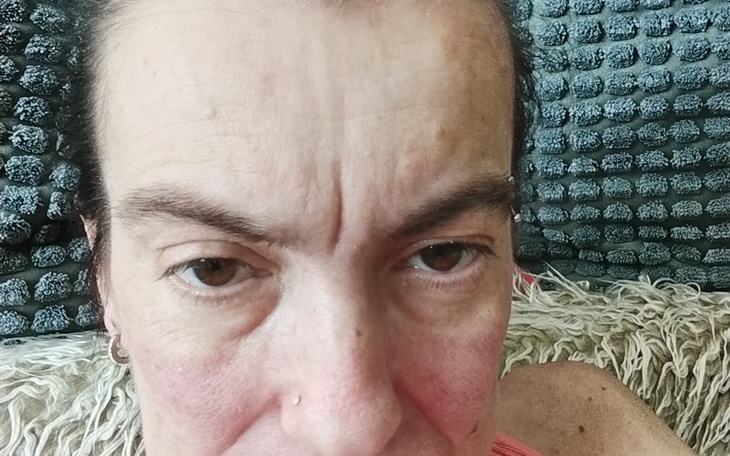 Zbiórka Leki i insulina paski do glukome - zdjęcie główne