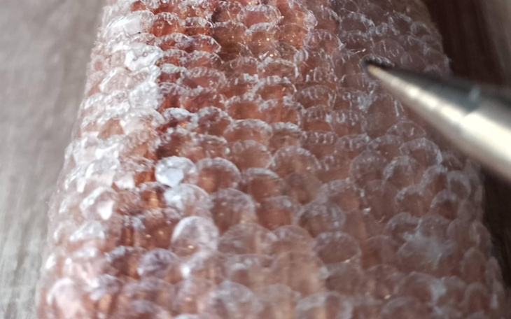 Zbliżenie na skórę z widocznymi bąblami.