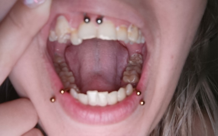 Osoba z kolczykami w języku, ukazująca otwarte usta.