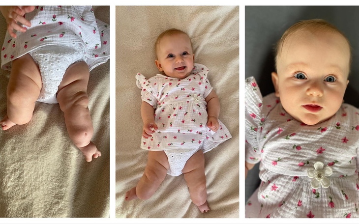 Zbiórka Maleństwo walczy o sprawność - zdjęcie główne