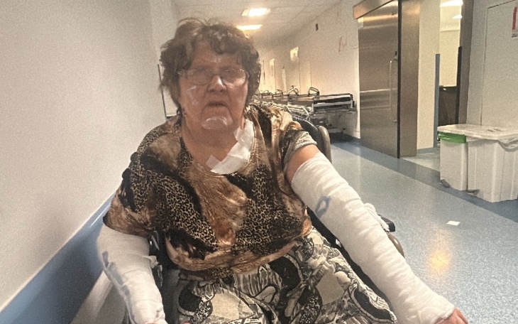 Kobieta w wózku inwalidzkim w szpitalu, z opatrunkami na rękach.