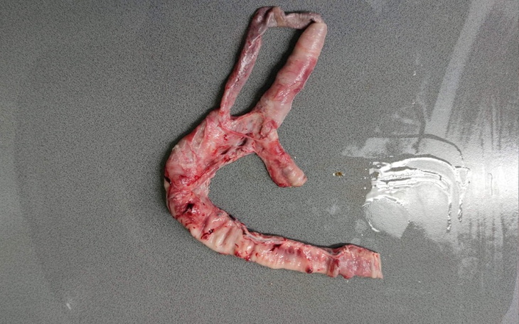 Zbiórka Wsparcie dobrowolne - zdjęcie główne