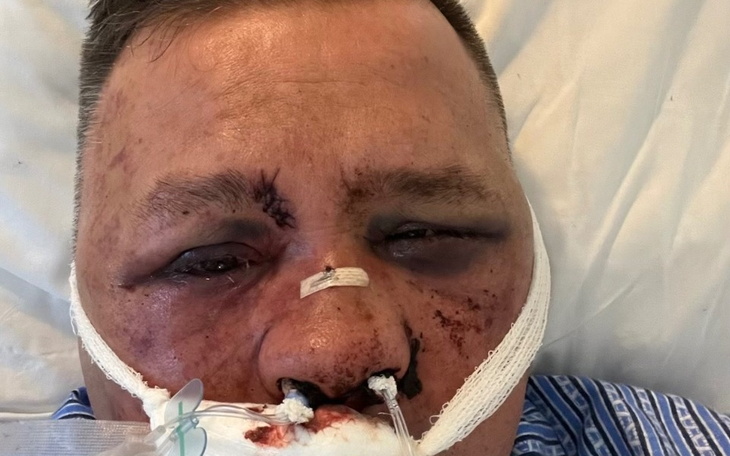 Zbiórka Ciężkie pobicie - zdjęcie główne