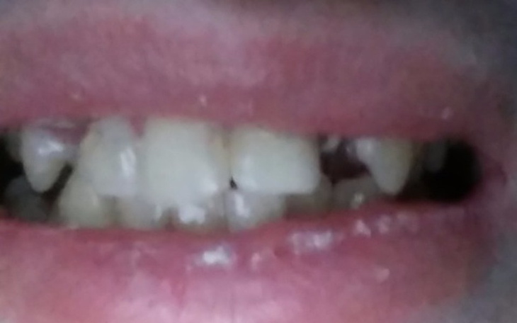 Zbiórka Leczenie zębów 22lata - zdjęcie główne