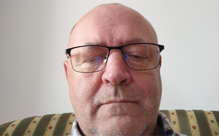 Zbiórka Zbieram na operację mózgu - zdjęcie główne