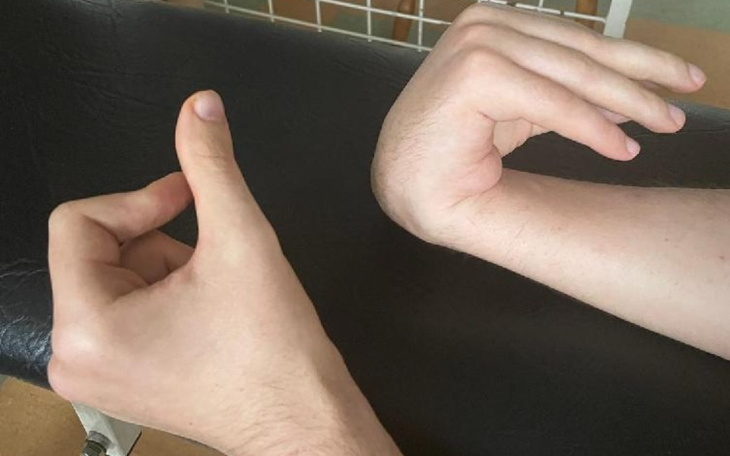 Zbiórka Choroba Wilsona - rehabilitacje - zdjęcie główne