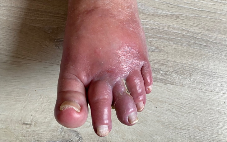 Zbiórka Pomóżcie mojej Babciuni - zdjęcie główne