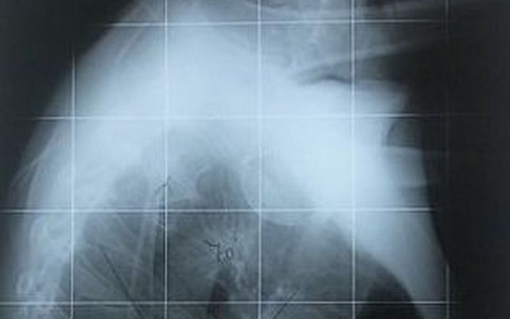 Zbiórka Rehabilitacja leczenie kręgosłup - zdjęcie główne