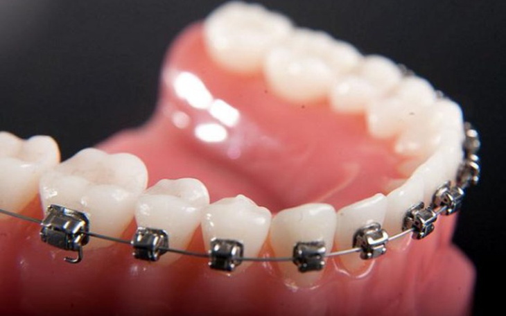 Zbiórka Aparat na zęby dla siostrzyczki - zdjęcie główne