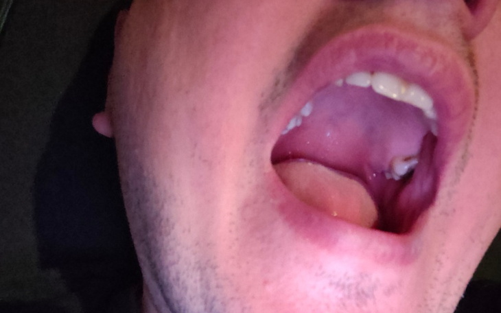 Zbiórka Na gybys - zdjęcie główne