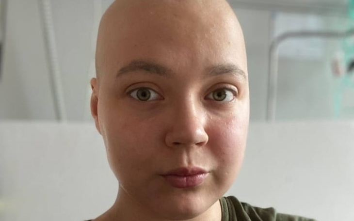 Bald girl looking at the camera with a calm expression.