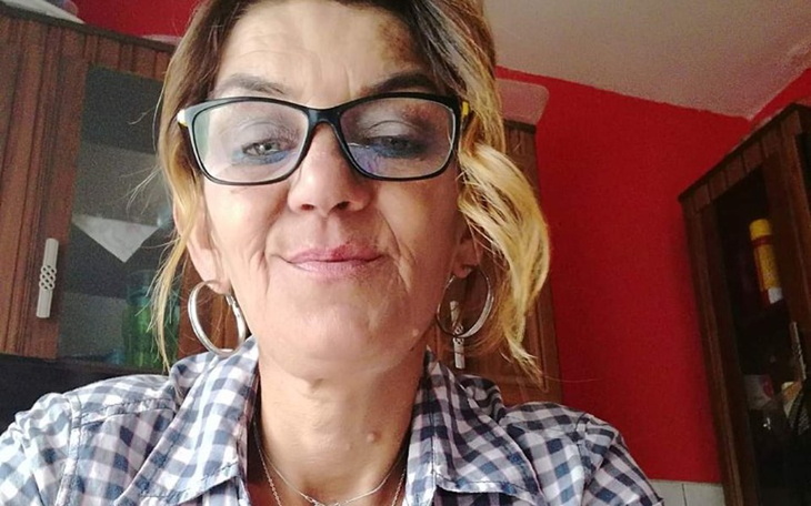 Zbiórka Badanie pet guz mózgu leczenie - zdjęcie główne