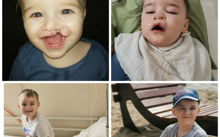 Zbiórka Leczenie Antka - małego bohatera - zdjęcie główne